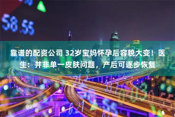 靠谱的配资公司 32岁宝妈怀孕后容貌大变！医生：并非单一皮肤问题，产后可逐步恢复